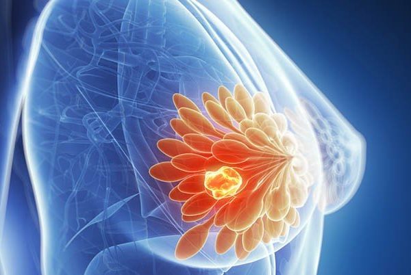 biópsia percutânea