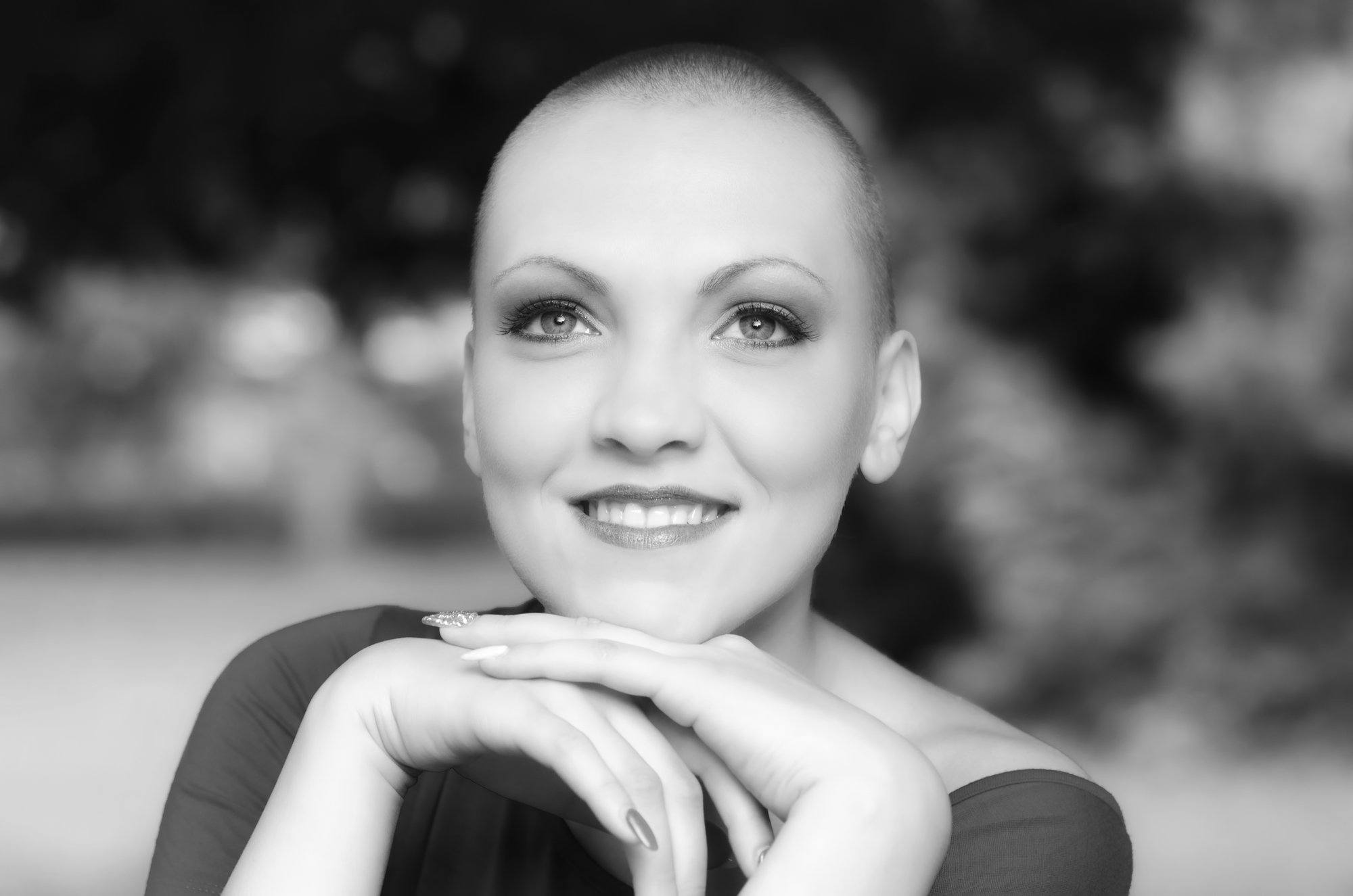 Alopecia induzida por quimioterapia