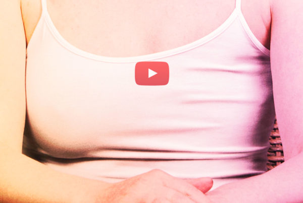 Mastectomias Skin Sparing