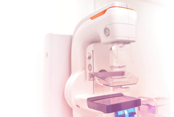 Existe algum exame que possa substituir a mamografia no rastreamento do câncer de mama?