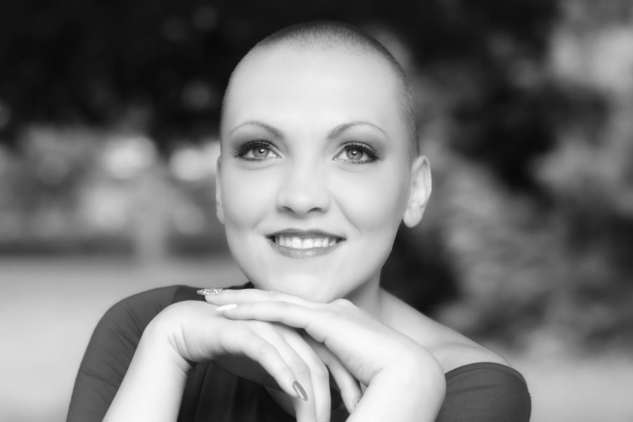 Alopecia induzida por quimioterapia
