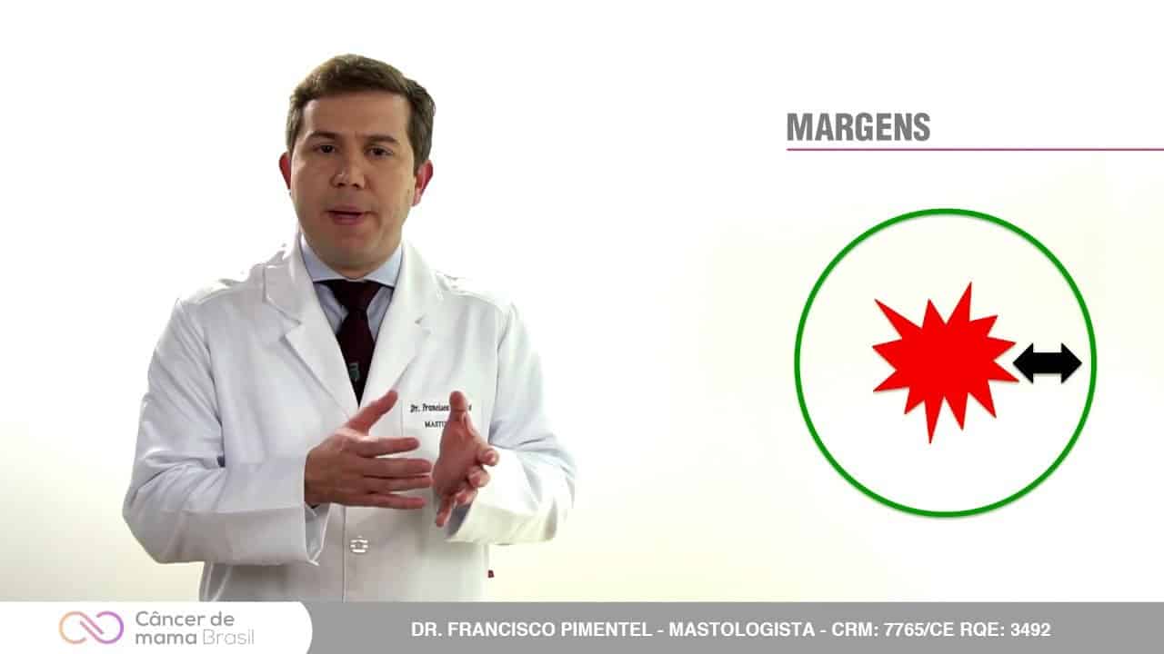 Cirurgia conservadora (Quadrantectomia) ou Mastectomia?