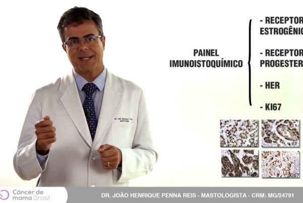 câncer de mama tem cura