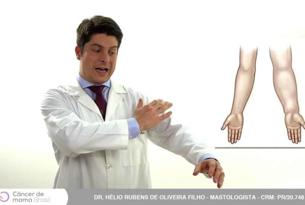 biópsia do linfonodo sentinela