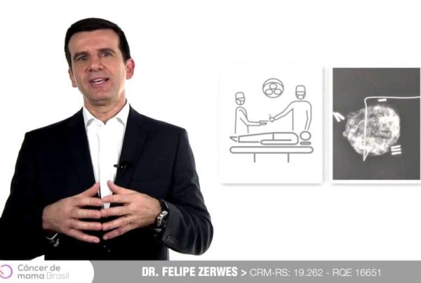 Câncer de Mama Brasil