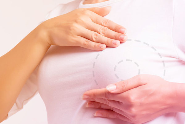 ADENOMASTECTOMIA