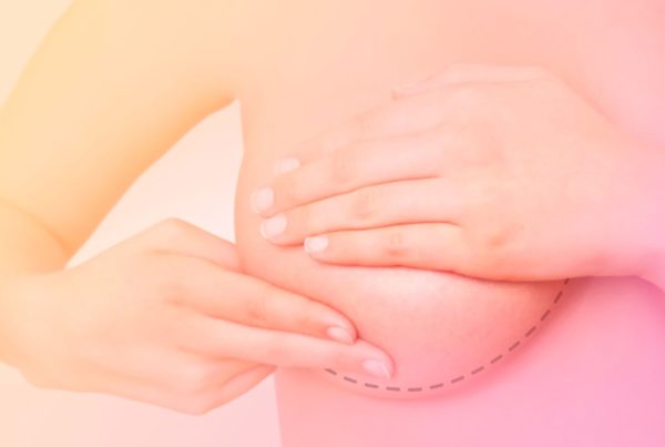 Mastoplastia em mama oposta após reconstrução contralateral