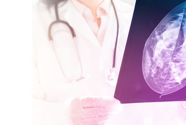 Como funciona a radiografia? Quando ela é usada? Existe radiação neste exame de imagem?