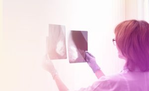 Quais são as alterações classificadas como BI-RADS™ 5 no exame mamográfico?