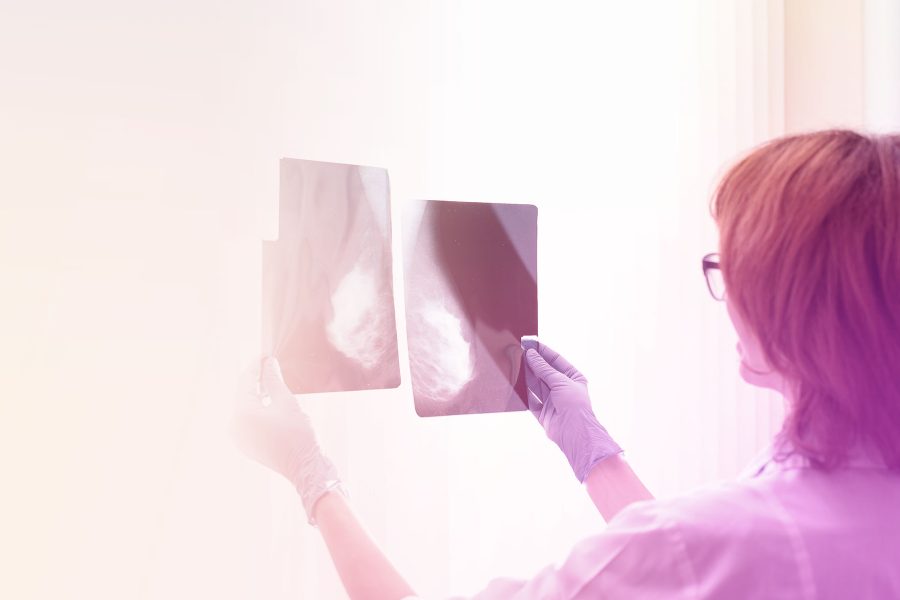 Quais são as alterações classificadas como BI-RADS™ 5 no exame mamográfico?